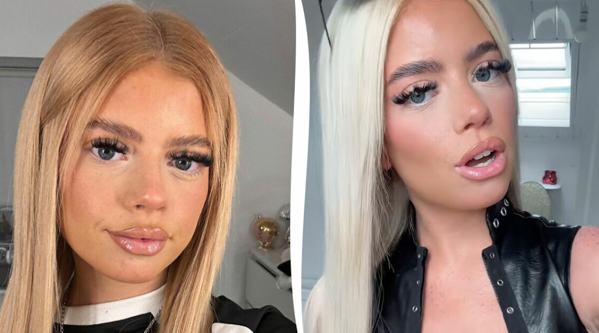 ”Jag var besatt av fransar och fillers – skillnaden får alla att gapa”