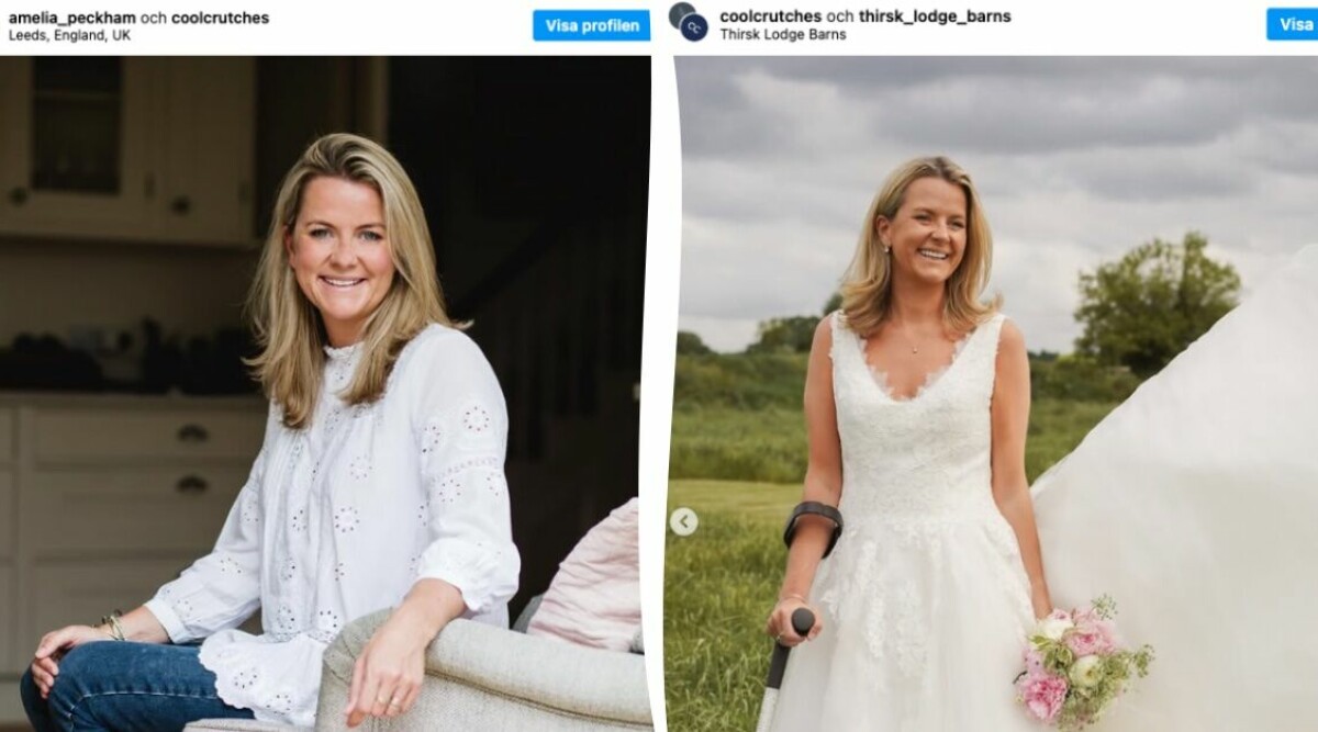 Amelia går med krycka – förnedrades inför bröllopet