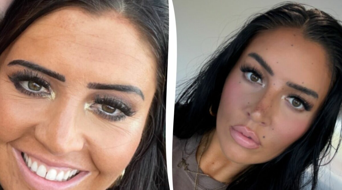 ”Alla tror att jag använt botox – men jag använder den här billiga produkten”