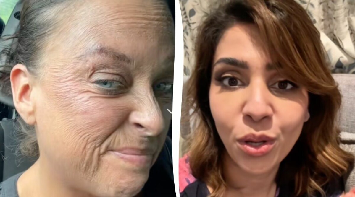 ”Retinol gjorde mig rynkig – jag visste inte att det här kunde hända”