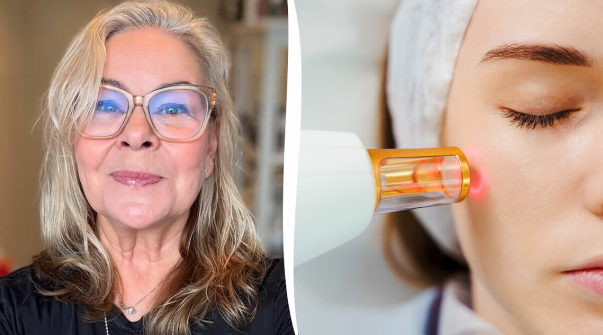 Sugen på att testa IPL-behandling? Här är allt du behöver veta