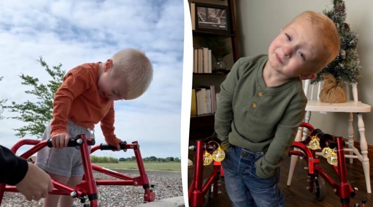Tvååriga pojken har en ovanlig diagnos – starka videon berör alla