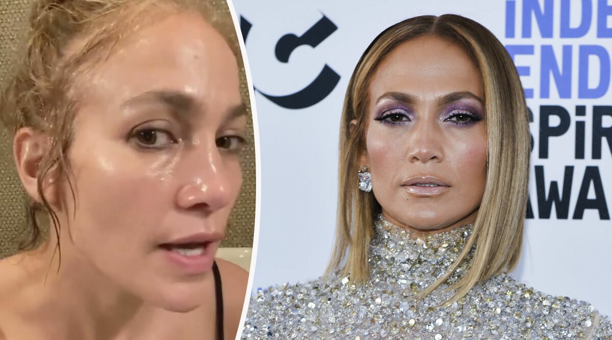 Jennifer Lopez berättar öppet om botox – efter anklagelserna