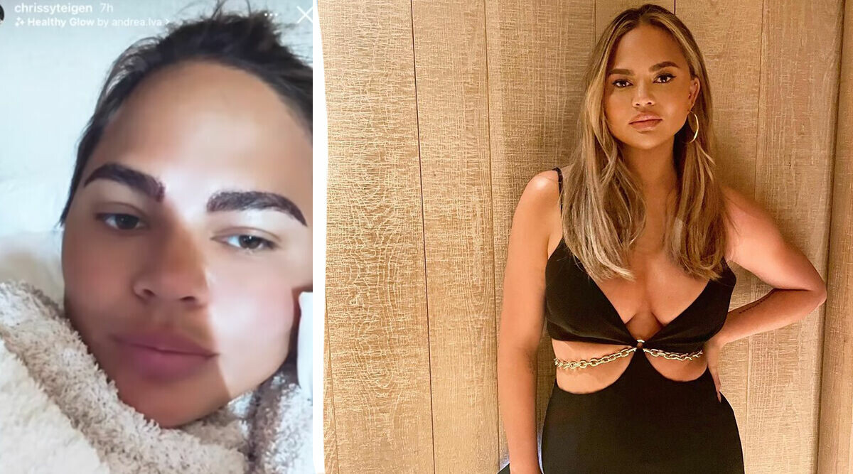 Chrissy Teigen transplanterar nya ögonbryn – varnar andra