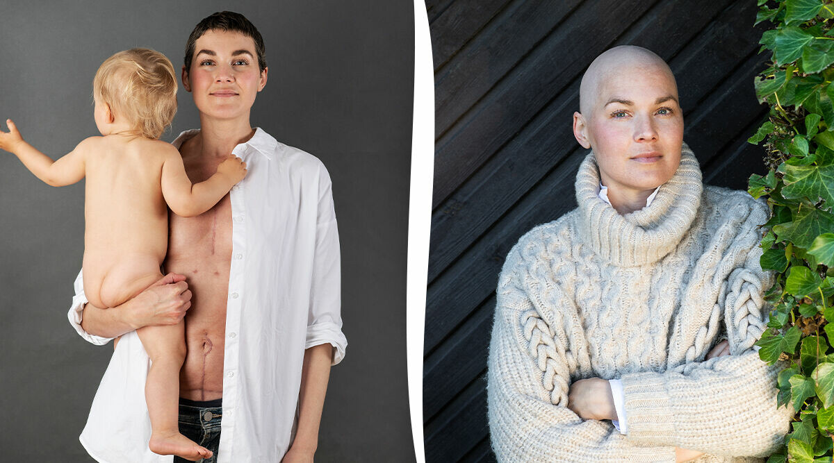 Småbarnsmamman Matildas ärliga bild av ett år med cancer