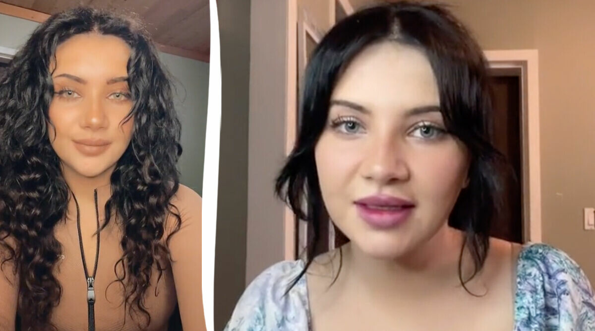 25-åringen: Jag förstörde mitt utseende med fillers