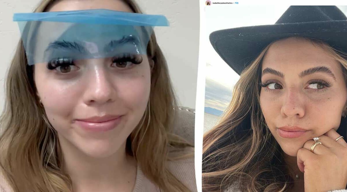 Isabelles varning efter misslyckade ögonbrynsbehandlingen
