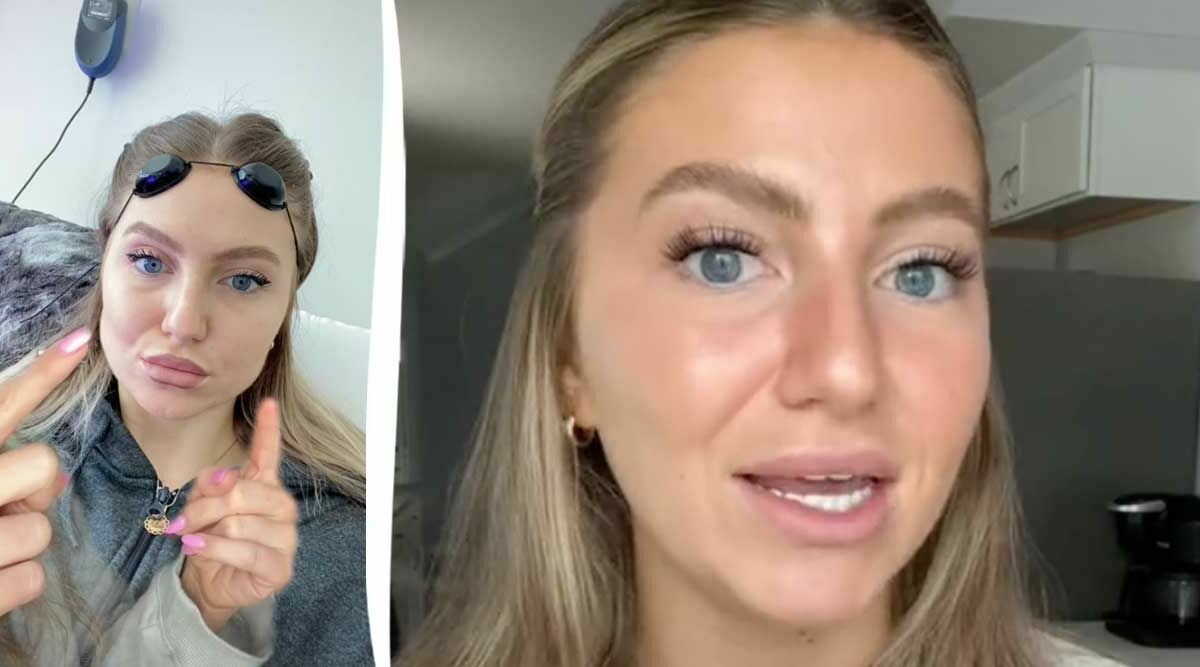 Yasmine ångrar ingreppet – vill hindra andra att göra samma misstag