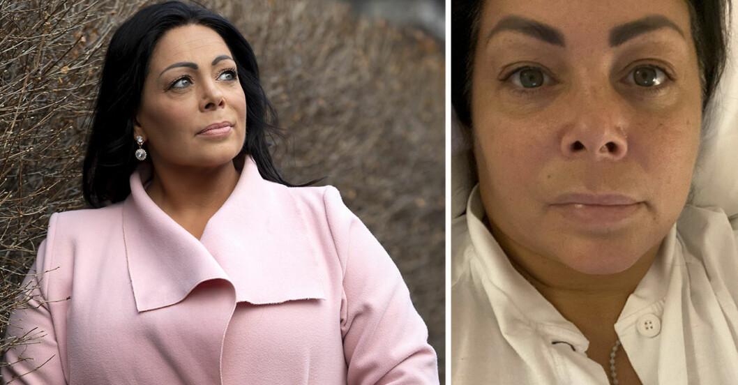 Anna Book om tuffa operationen – efter insjuknandet i covid-19