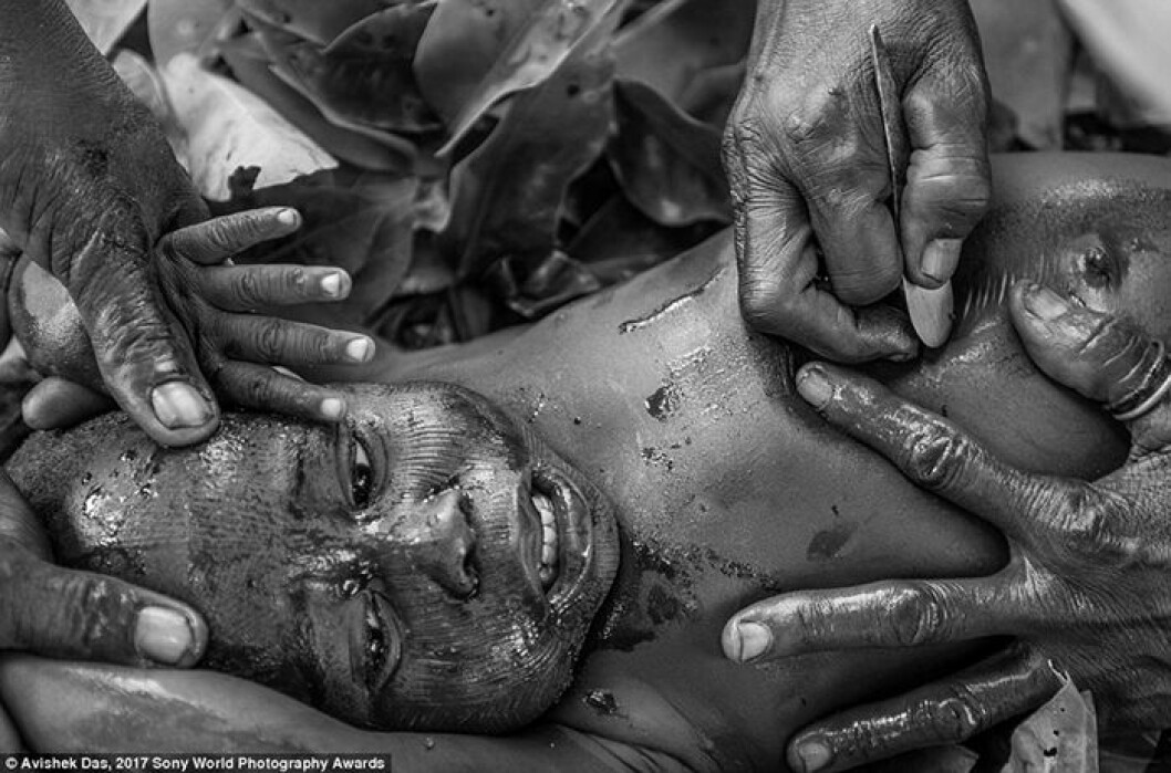 Benin, Västafrika. En tvååring i stammen Betamarribe genomgår en ärr-ceremoni, de traditionella ärren ska visa vilken stam han tillhör. Fotograf: Avishek Das