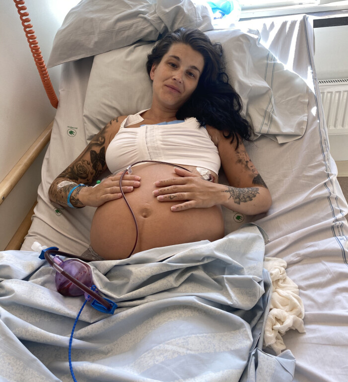Elin Ekman efter att hon har fått bröstet med tumören bortopererad. Elin Ekman efter att hon har opererat bort sitt ena bröst pågrund av sin cancer