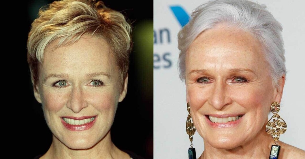 Glenn Close.