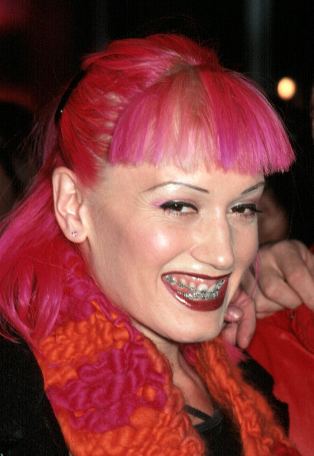 Gwen Stefani bjuder på ett riktigt Hollywood-smile! Gwen stefani med tandställning