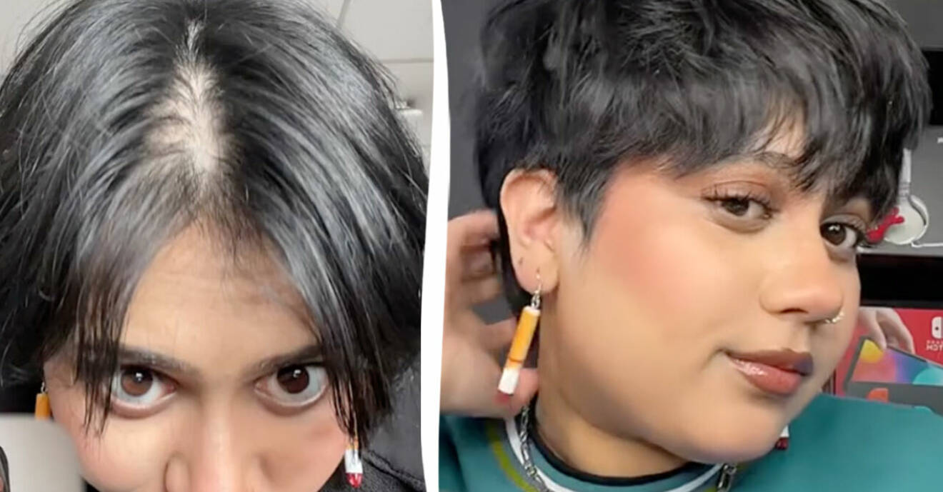 Kvinnans håravfall före och efter.