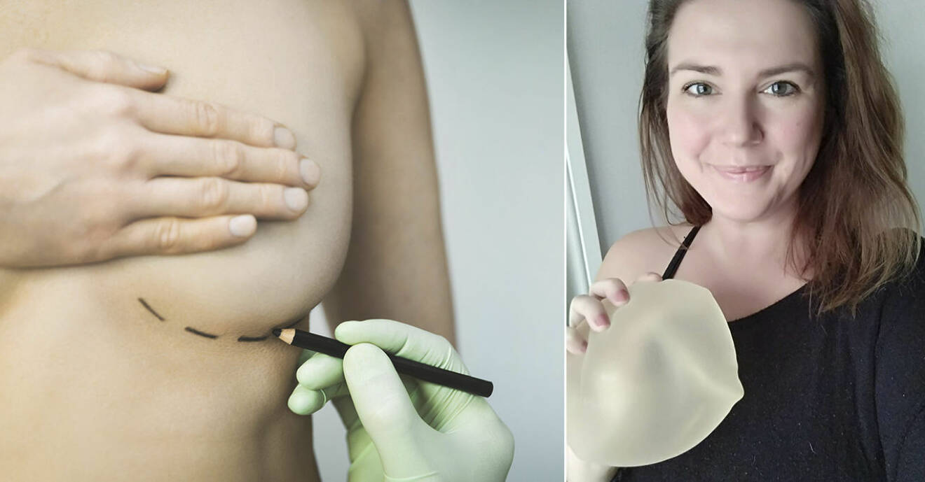 Breast implant illness.