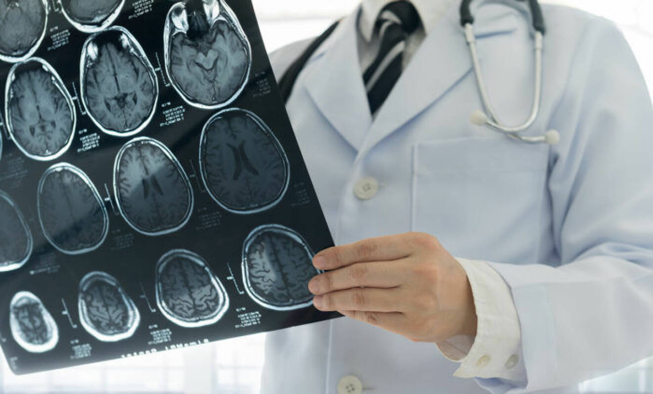 Röntgenbild över hjärna