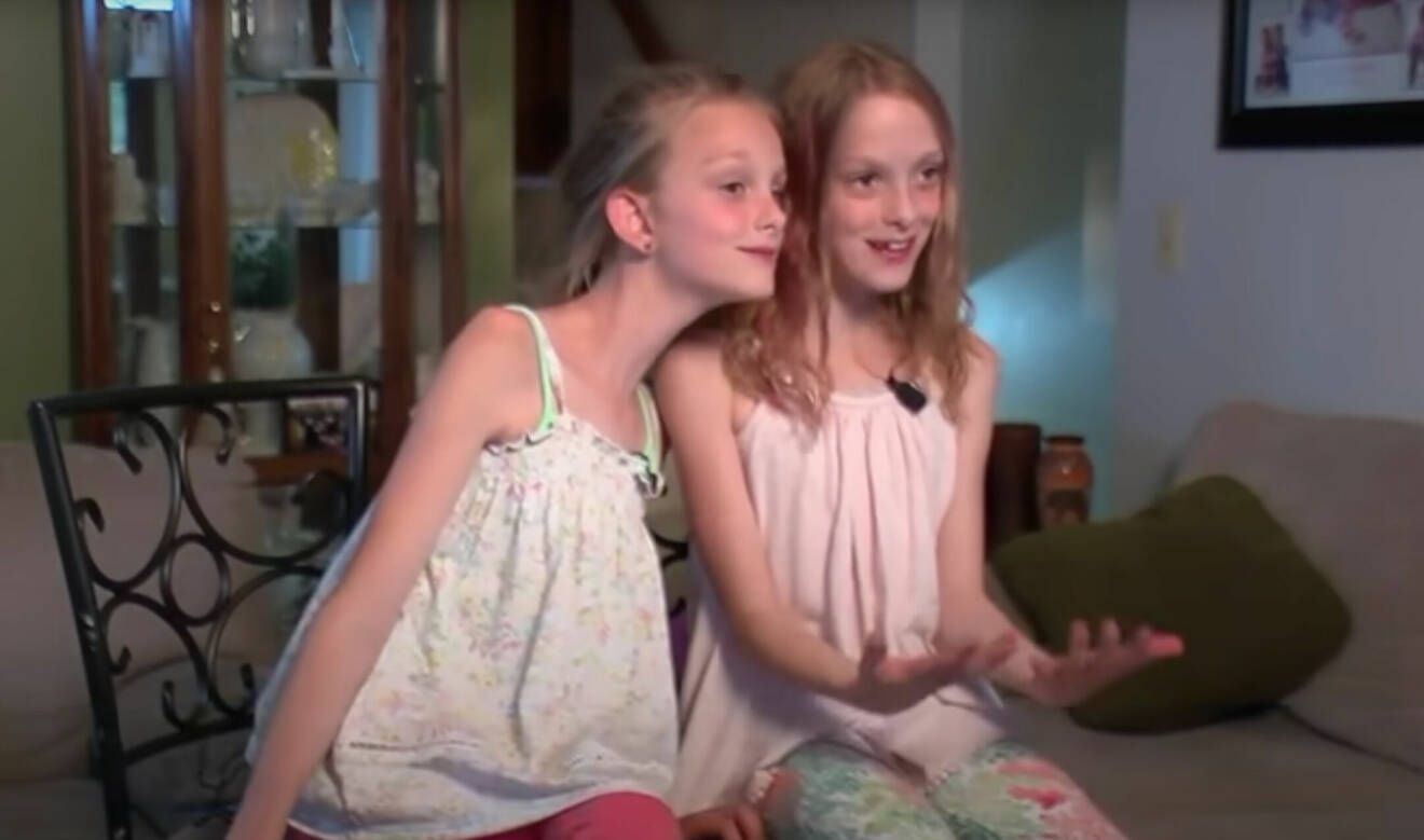 Systrarna, födda som siamesiska tvillingar, Isabelle och Abby Carlsen år 2016.