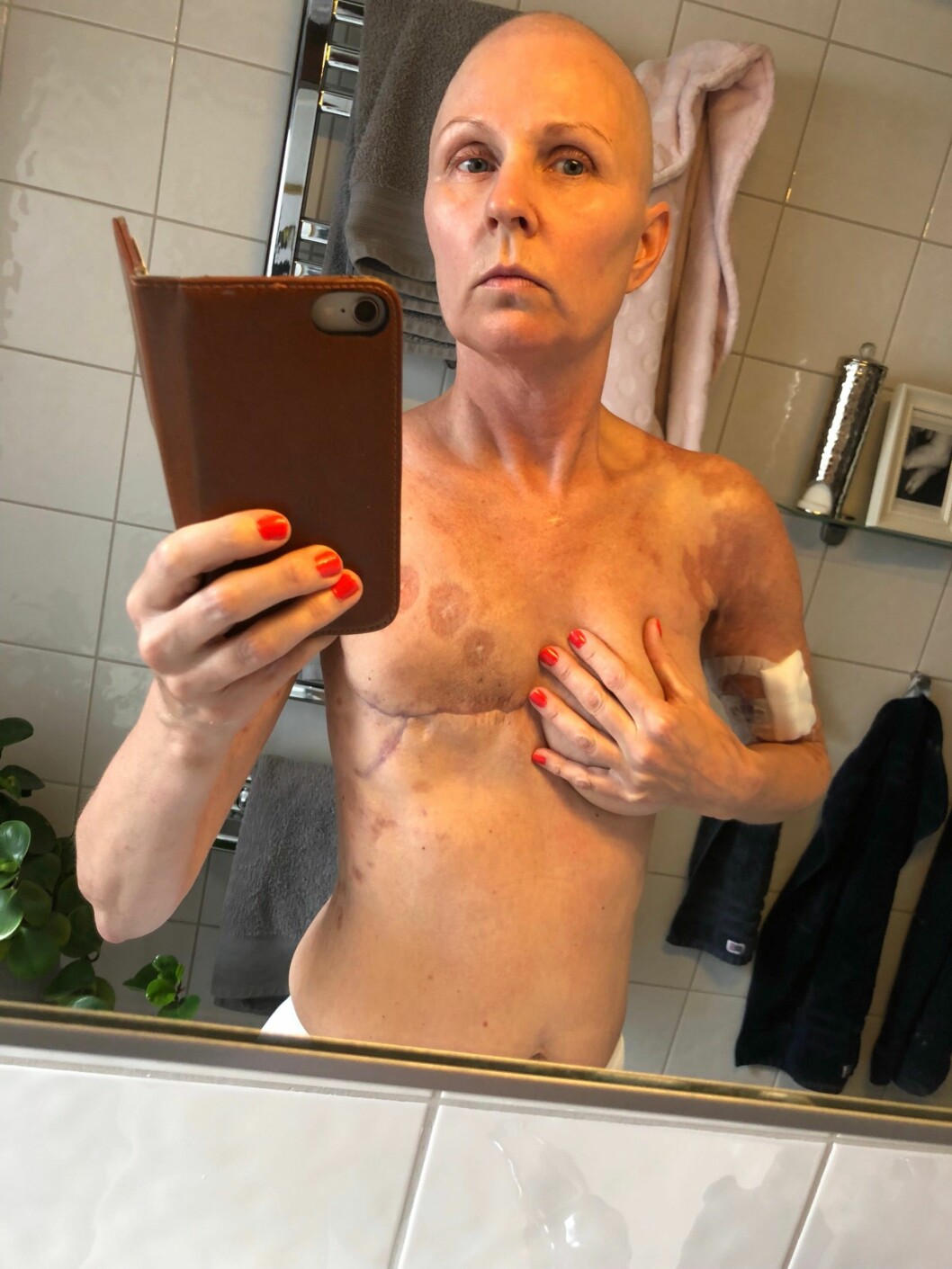 Under våren 2018 drabbades Anna Wahlstam av cancer för andra gången.