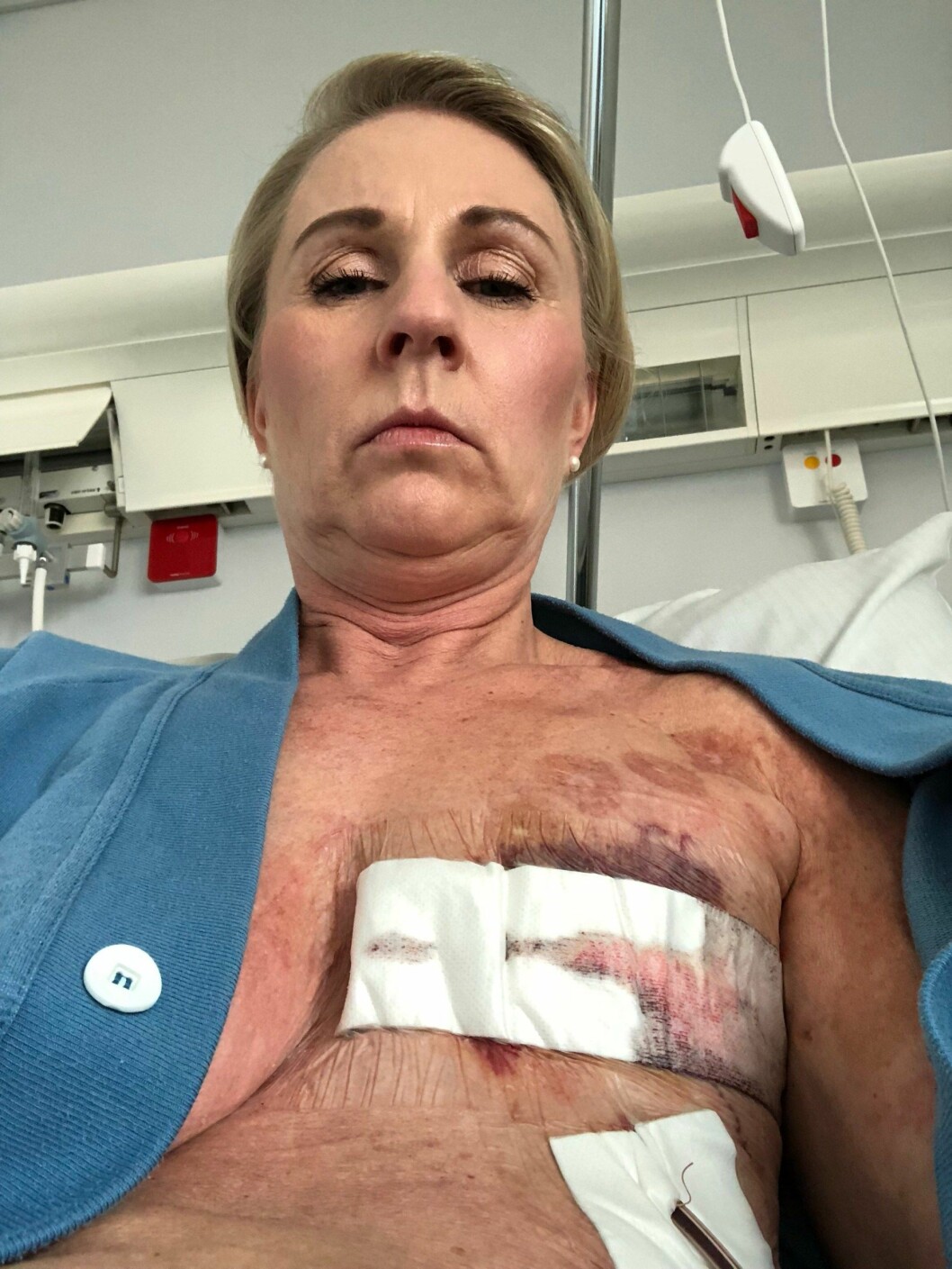 Elva år efter leukemin fick Anna Wahlstam en ny allvarlig cancerdiagnos och tvingades göra en masektomi.