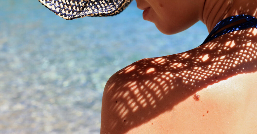 Kvinna i solhatt visar axel med hudfläckar