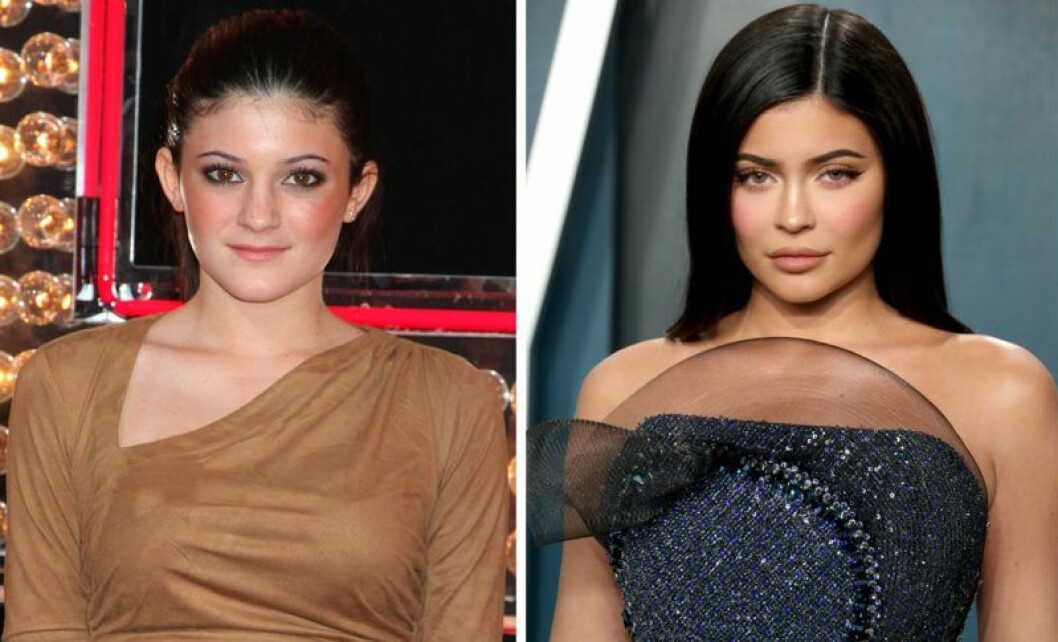 Kylie Jenner 2010 vs i dag. Kylie Jenner före och efter
