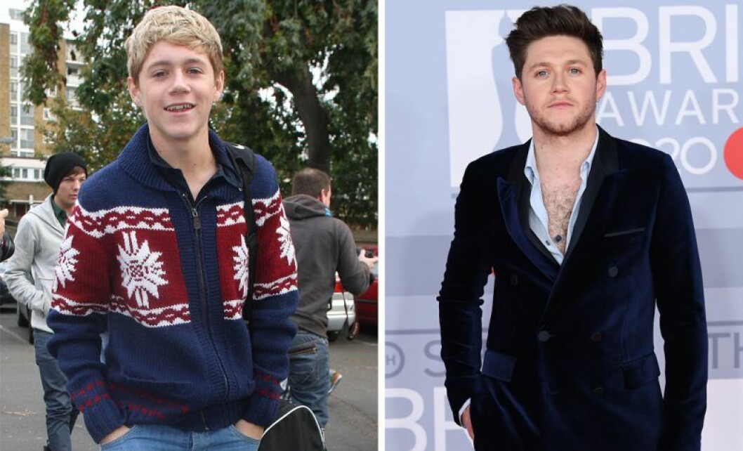 Niall Horan 2010 vs i dag. Niall Horan 2010 och 2020