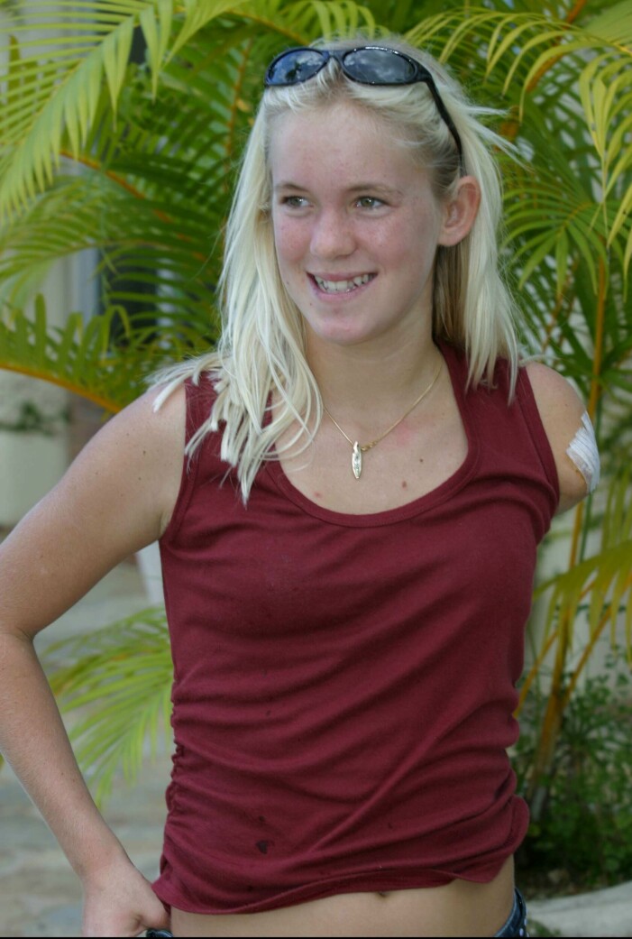 Bethany Hamilton kort efter sin olycka.
