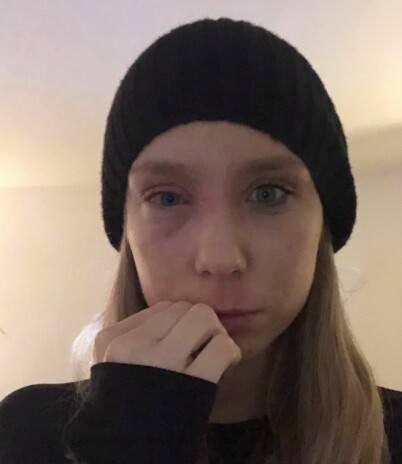 Linda från tiden då hon mådde som värst. Foto: Privat