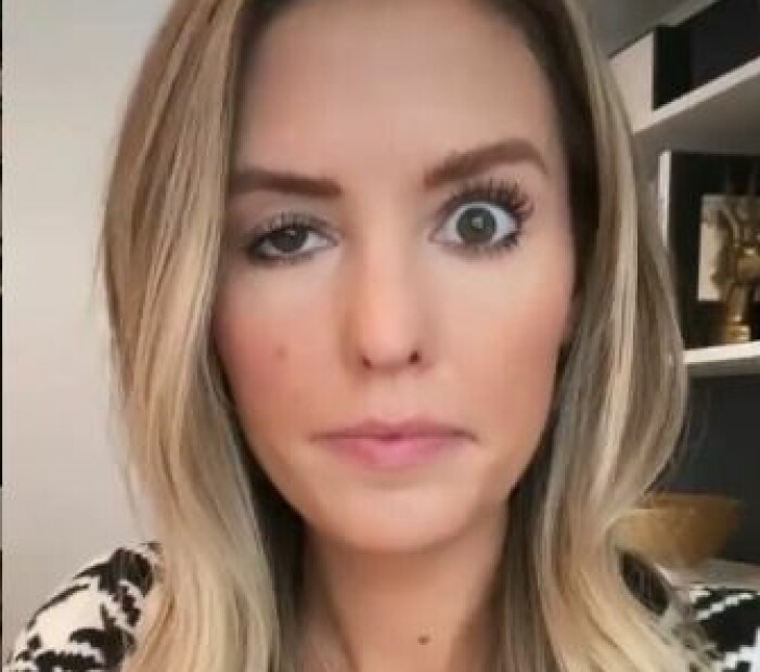 Whitney visar hur hennes öga ser ut efter misslyckad botox.