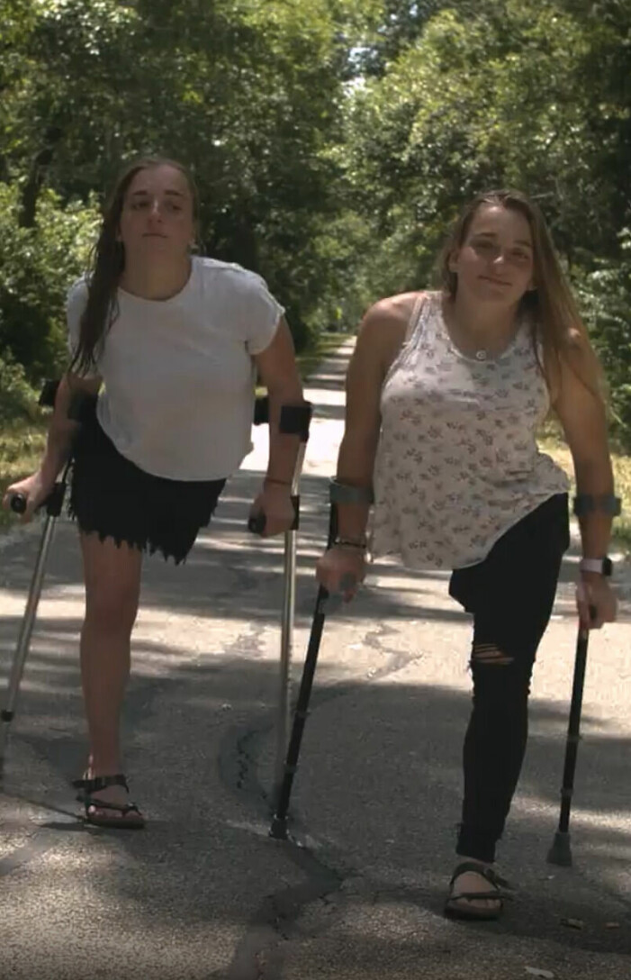 Mackenzie och Macey måste gå med kryckor.