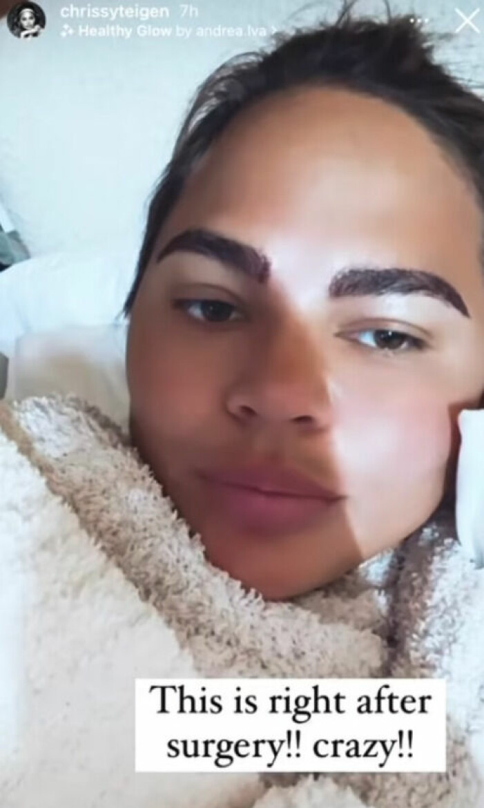 Chrissy Teigen visar ögonbrynen på Instagram Story.