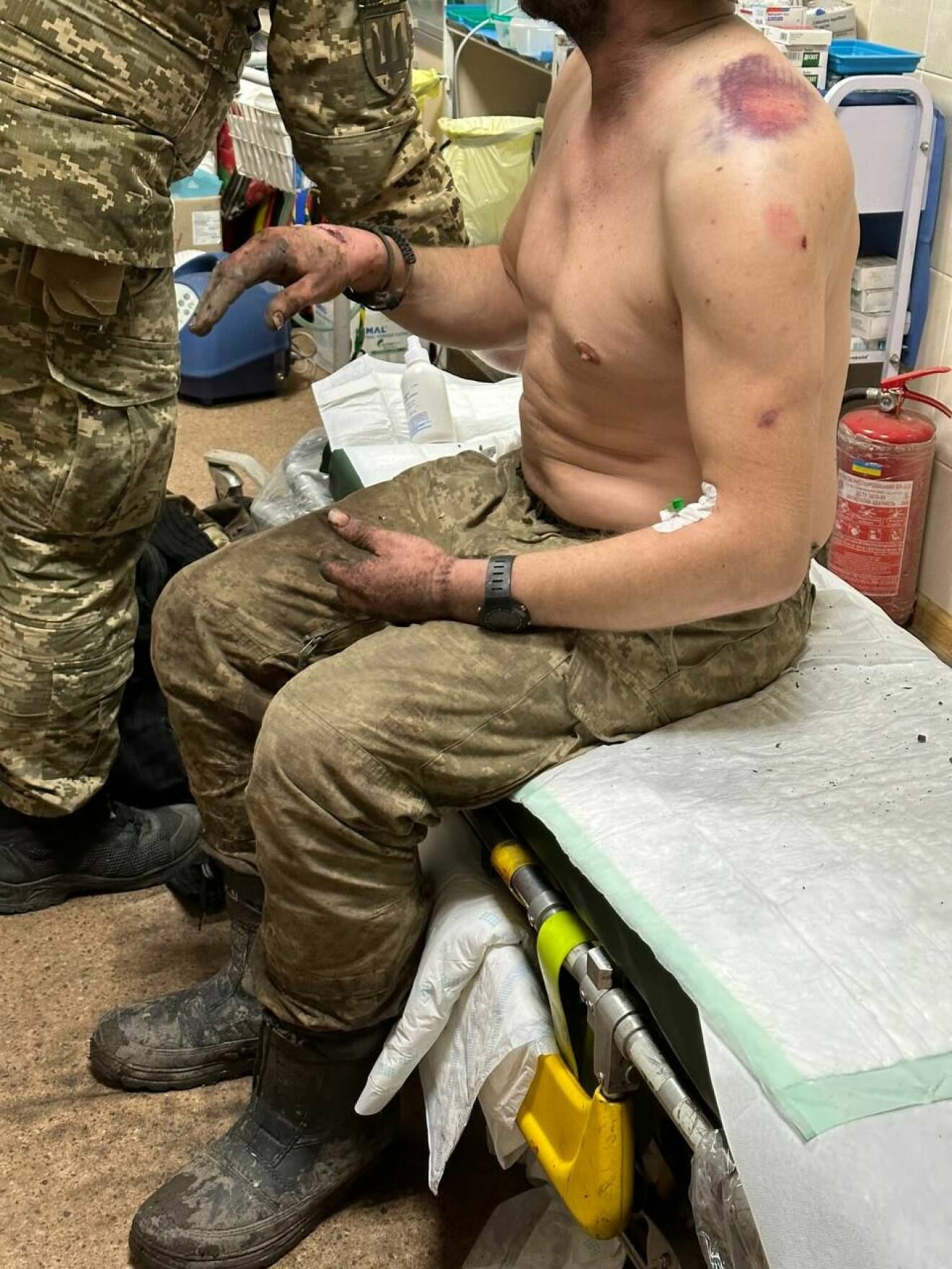 En skadad soldat i Ukraina.