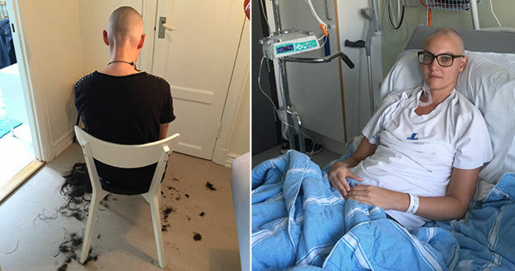 Susanne var först livrädd för att tappa håret, men det snaggade huvudet gav henne bara ännu mer kämparvilja. Foto: Nimrod Ashkenazi Inför transplantationen fick Susanne cellgifter och tappade håret. Något som hon först tyckte var väldigt jobbigt, men som senare gav henne ännu mer styrka.